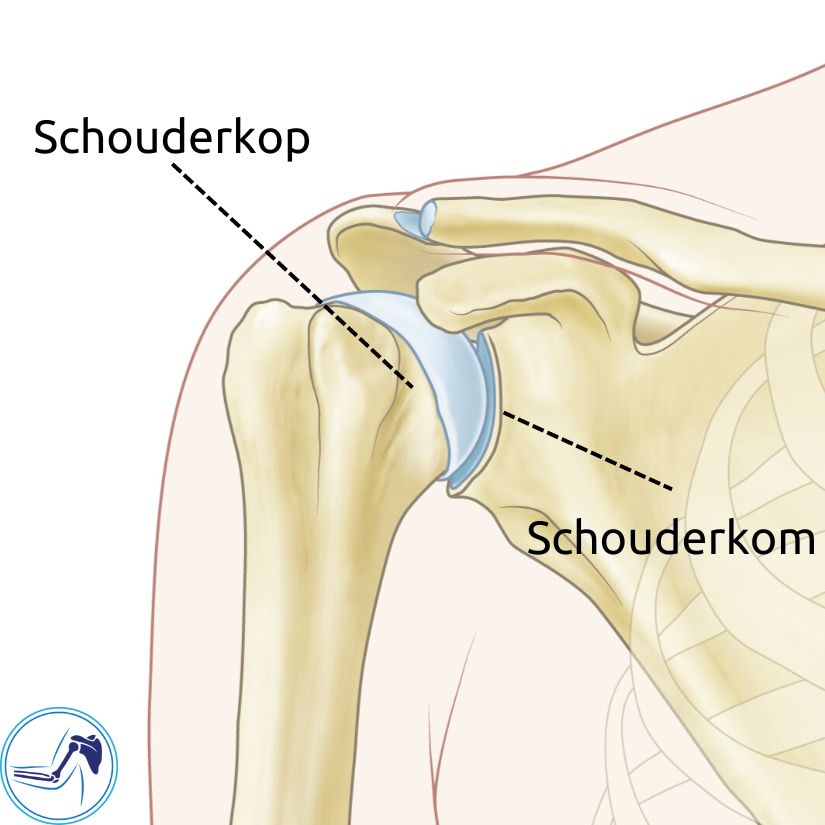 Een normaal schoudergewricht bestaat uit een schouderkop met kraakbeen erop en een schouderkom met kraakbeen erop. De schouderkom is het uiteinde van het schouderblad.
